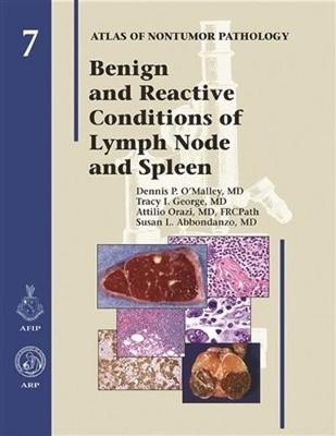 Benign and Reactive Conditions of Lymph Node and Spleen - O'Malley, Dennis P