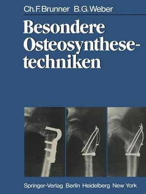 Besondere Osteosynthesetechniken - Brunner, C F, and Weber, B G