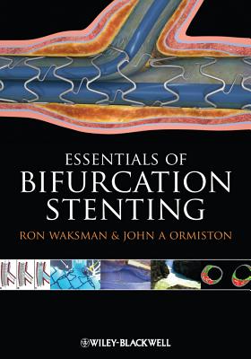 Bifurcation Stenting - Waksman, Ron, and Ormiston, John A.