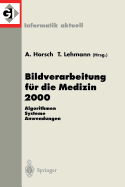 Bildverarbeitung Fur Die Medizin 2000: Algorithmen - Systeme - Anwendungen