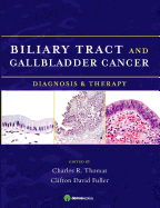Biliary Tract and Gallbladder Cancer: Diagnosis and Therapy