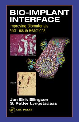 Bio-Implant Interface: Improving Biomaterials and Tissue Reactions - Ellingsen, J E, and Lyngstadaas, S P