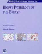Biopsy pathology of the breast.