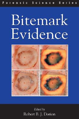 Bitemark Evidence - Dorion, Robert B J (Editor)