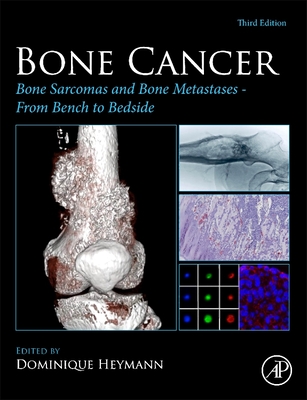 Bone Cancer: Bone Sarcomas and Bone Metastases - From Bench to Bedside - Heymann, Dominique (Editor)