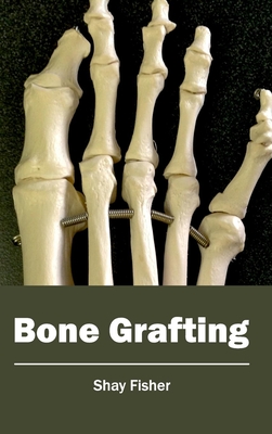 Bone Grafting - Fisher, Shay (Editor)