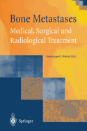 Bone Metastases: Medical, Surgical and Radiological Treatment