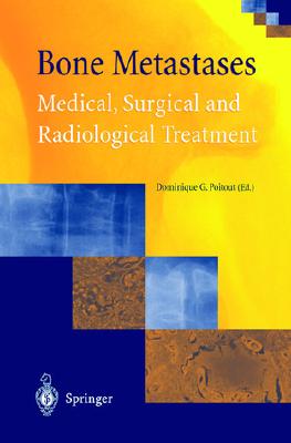 Bone Metastases: Medical, Surgical and Radiological Treatment - Poitout, Dominique G (Editor)