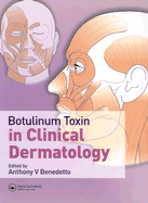 Botulinum Toxin in Clinical Dermatology