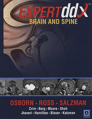 Brain and Spine - Osborn, Anne G, MD, and Ross, Jeff, MD, and Crim, Julia, MD