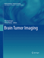 Brain Tumor Imaging