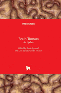 Brain Tumors: An Update