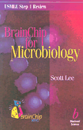 BrainChip for Microbiology