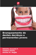 Branqueamento de dentes dec?duos e permanentes jovens