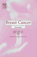 Breast Cancer: A Practical Guide