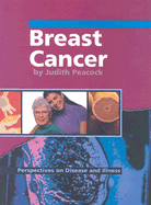 Breast Cancer - Peacock, Judith, and Anderson, Sharol, B.S.N., R.N., O.C.N. (Consultant editor)