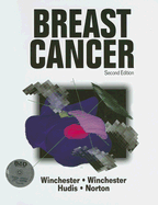 Breast Cancer