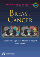 Breast Cancer