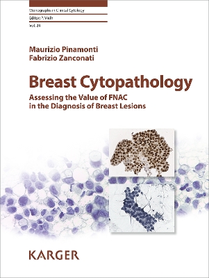 Breast Cytopathology: Assessing the Value of FNAC in the Diagnosis of Breast Lesions - Pinamonti, M., and Zanconati, F., and Vielh, Philippe (Series edited by)