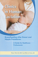 Breastfeeding After Breast and Nipple Procedures: A Guide for Healthcare Professionals