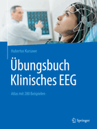 ?bungsbuch Klinisches Eeg: Atlas Mit 280 Beispielen