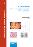 Cncer renal: Nuevas estrategias terap?uticas m?dico-quirrgicas