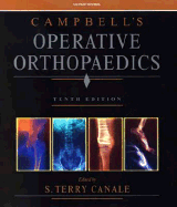 Campbell's Operative Orthopedics: CD-Rom, 4-Volume Set