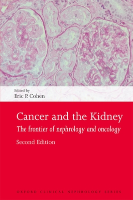 Cancer and the Kidney: The frontier of nephrology and oncology - Cohen, Eric P. (Editor)
