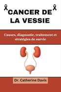 Cancer de la vessie: Causes, diagnostic, traitements et stratgies de survie