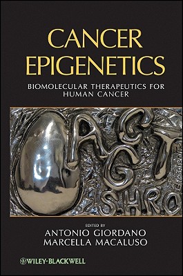 Cancer Epigenetics: Biomolecular Therapeutics in Human Cancer - Giordano, Antonio, MD (Editor), and Macaluso, Marcella (Editor)