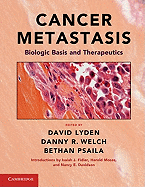 Cancer Metastasis: Biologic Basis and Therapeutics