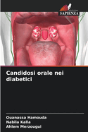 Candidosi orale nei diabetici