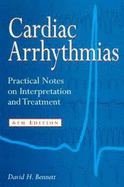 Cardiac Arrhythmias: Practical Notes on Interpretation and Treatment