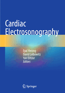 Cardiac Electrosonography