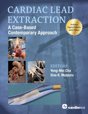 Cardiac Lead Extraction: A Case-Based Contemporary Approach - Mulpuru, Siva K. (Editor), and Cha, Yong-Mei (Editor)