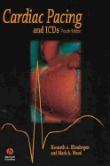 Cardiac Pacing and Icds