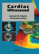 Cardiac ultrasound