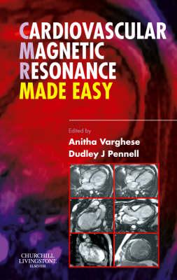 Cardiovascular Magnetic Resonance Made Easy - Varghese, Anitha, and Pennell, Dudley J, MD, Frcp, Facc