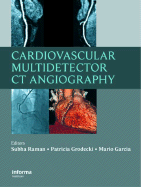 Cardiovascular Multidetector CT Angiography