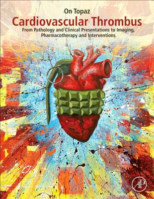 Cardiovascular Thrombus: From Pathology and Clinical Presentations to Imaging, Pharmacotherapy and Interventions - Topaz, On (Editor)