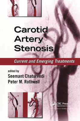 Carotid Artery Stenosis: Current and Emerging Treatments - Chaturvedi, Seemant (Editor), and Rothwell, Peter M. (Editor)