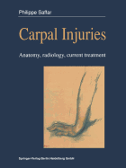 Carpal Injuries: Anatomy, Radiology, Current Treatment