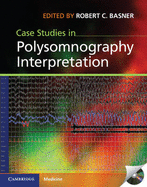 Case Studies in Polysomnography Interpretation - Basner, Robert C. (Editor)