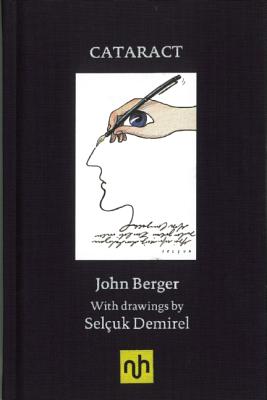 Cataract: Some Notes After Having a Cataract Removed - Berger, John