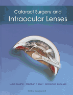 Cataract Surgery and Intraocular Lenses