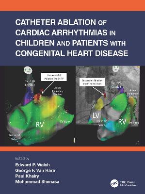 Catheter Ablation of Cardiac Arrhythmias in Children and Patients with Congenital Heart Disease - Walsh, Edward P (Editor), and Hare, George F Van (Editor), and Khairy, Paul (Editor)