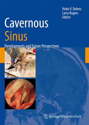 Cavernous Sinus: Developments and Future Perspectives - Dolenc, Vinko V (Editor), and Rogers, Larry (Editor)