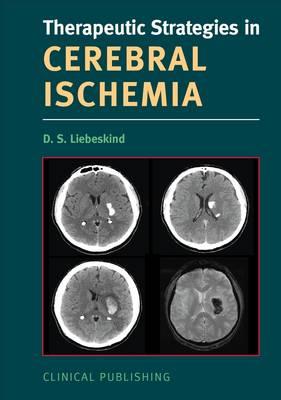 Cerebral Ischemia - Liebeskind, D.S. (Editor)