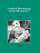 Cerebral Monitoring in the or and ICU