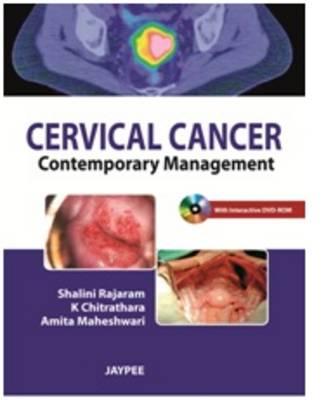 Cervical Cancer: Contemporary Management - Rajaram, Shalini, and Chitrathara, K, and Maheshwari, Amita